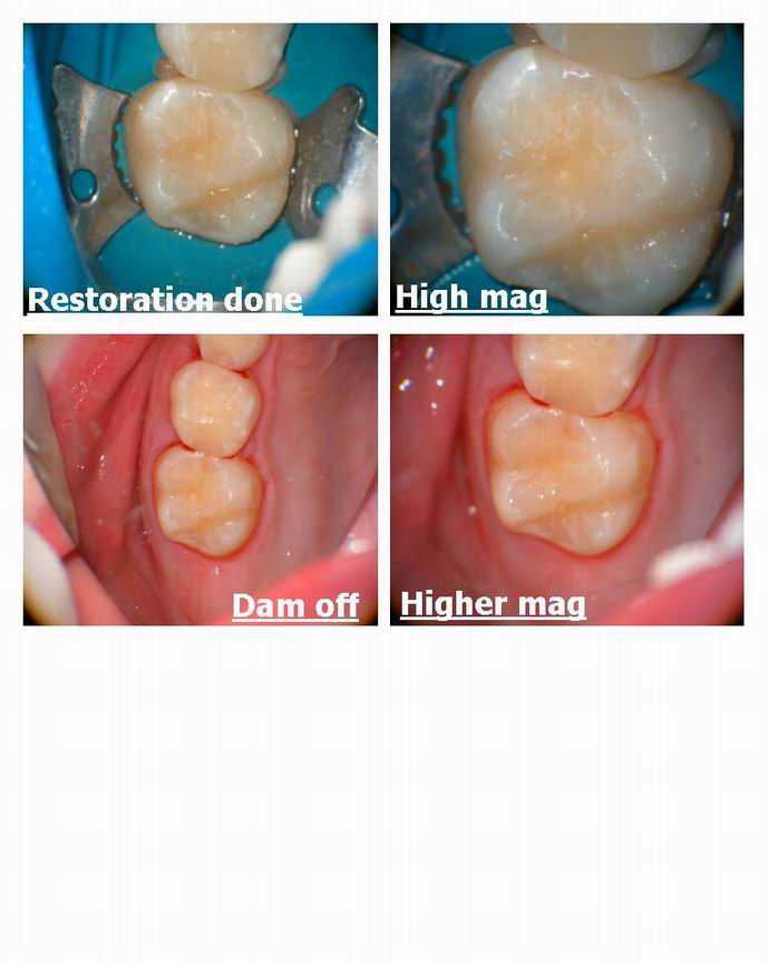 Resize of Microdental bubble in FS pg 3.jpg